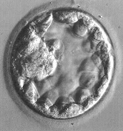Blastocyst1
